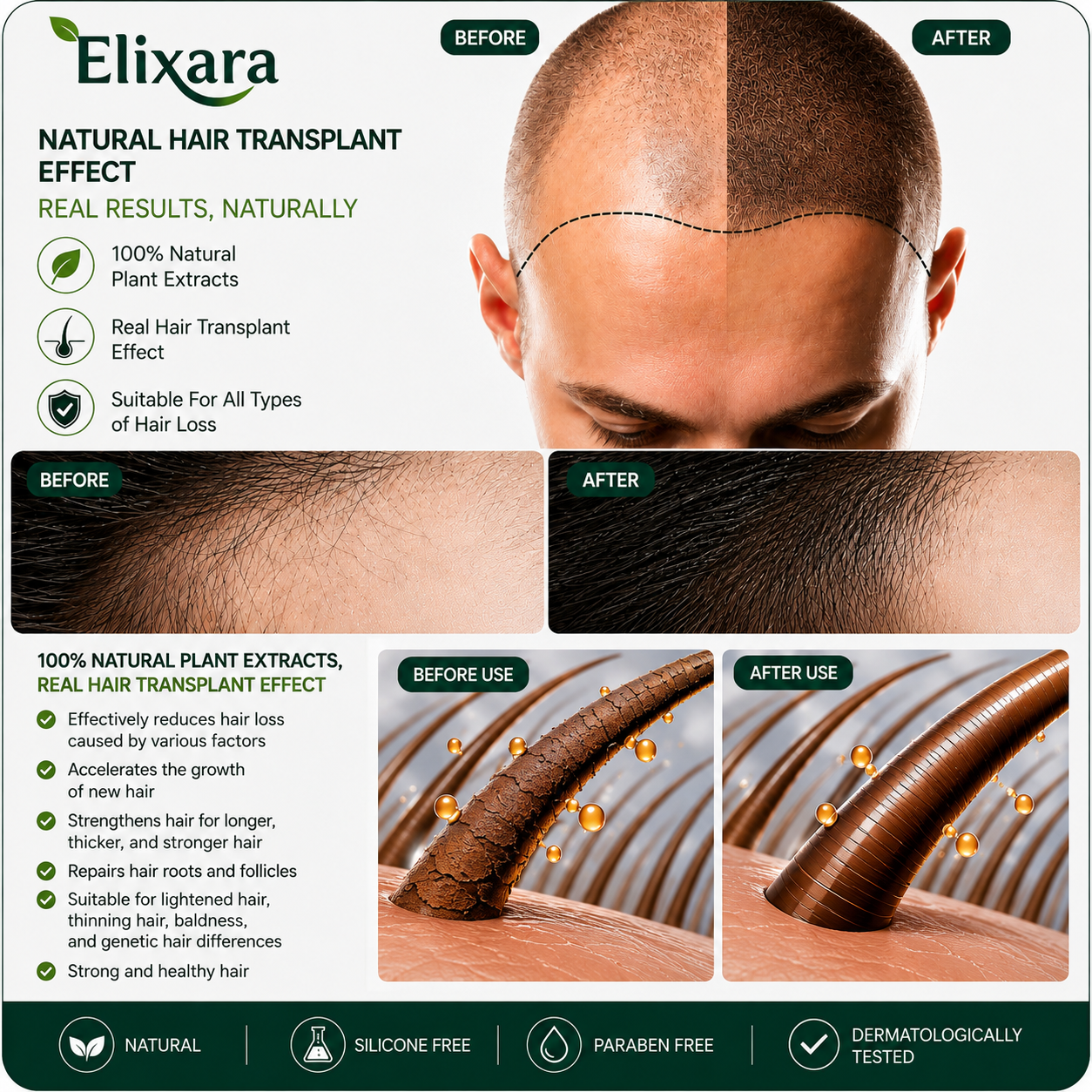 ELIXARA — Intensive Hair Growth Serum